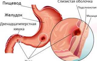 Если болит живот и спина с правой стороны