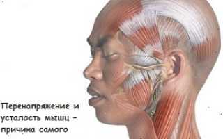 От любого напряжения болит голова