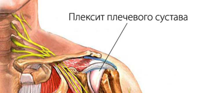 Болит спина шея и ключицы