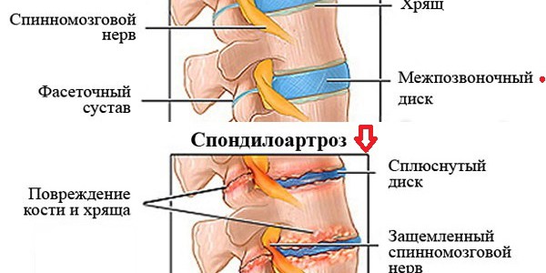 Виды болей в спине и диагноз