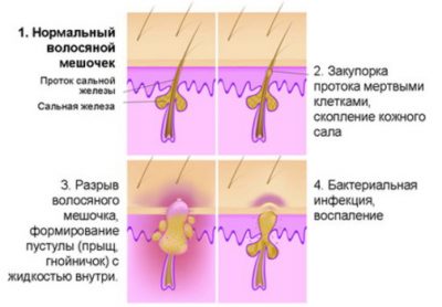 Болит кожа головы выподаю волосы