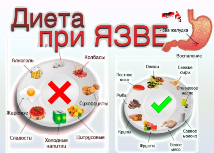 Болит низ спины после еды