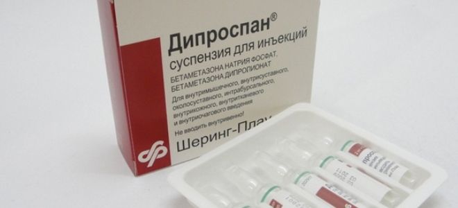 инъекции от боли в спине