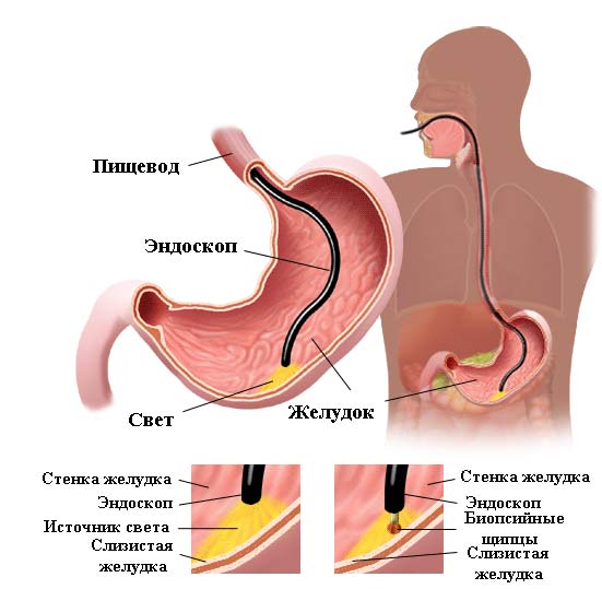 Болит низ спины после еды