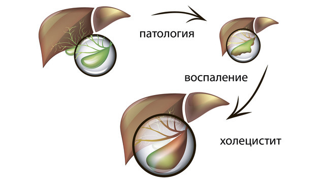 Спина болит когда утром встаю