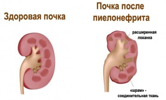 Сильно болит спина и температура 37