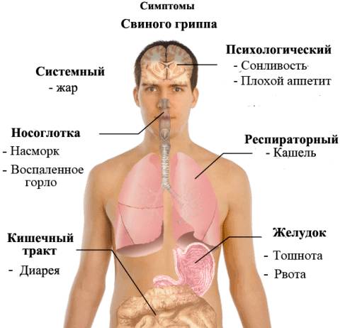 Симптомы свиного гриппа
