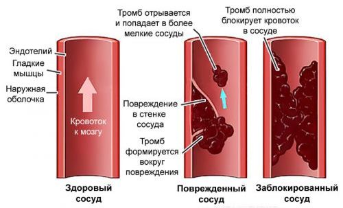 может ли болеть голова от кардиомагнила